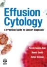 Effusion Cytology : A Practical Guide to Cancer Diagnosis - Book