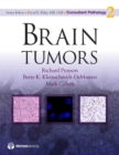 Brain Tumors - eBook