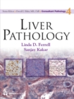 Liver Pathology - eBook