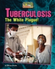 Tuberculosis - eBook