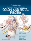 Cleveland Clinic Illustrated Tips and Tricks in Colon and Rectal Surgery - eBook