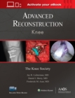 Advanced Reconstruction: Knee: Print + Ebook with Multimedia - Book