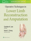 Operative Techniques in Lower Limb  Reconstruction and Amputation - Book