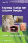 Cutaneous Toxicities from Anticancer Therapies - Book