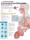 Understanding Coronavirus Disease 2019 (COVID-19) Anatomical Chart - Book