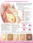 Understanding Breast Cancer Anatomical Chart - Book