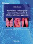 Manifestations Dermatologiques DES Connectivites Vasculites ET Affections Systemiques Apparentees - Book