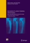 Revision of loose femoral prostheses with a stem system based on the "press-fit" principle : A concept and its system of implants, a method and its results - eBook