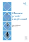 Glaucome primitif a angle ouvert : Rapport SFO 2014 - eBook