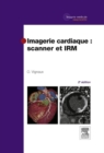 Imagerie cardiaque : scanner et IRM - eBook
