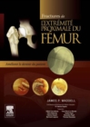Fractures de l'extremite proximale du femur : Ameliorer le devenir du patient - eBook