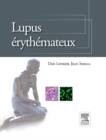 Lupus erythemateux - eBook