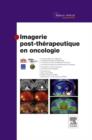 Imagerie post-therapeutique en oncologie - eBook