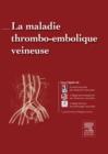 La maladie thrombo-embolique veineuse - eBook