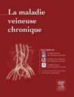 La maladie veineuse chronique - eBook