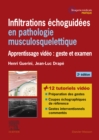 Infiltrations echoguidees en pathologie musculosquelettique : Apprentissage video : geste et examen - eBook