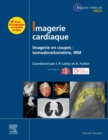 Imagerie cardiaque : Imagerie en coupes : scanner, IRM - eBook