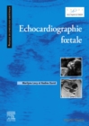 Echocardiographie fœtale - eBook