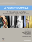 Le poignet traumatique 10 interventions courantes : Manuel de chirurgie du membre superieur - eBook