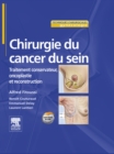 Chirurgie du cancer du sein : Traitement conservateur, oncoplastie et reconstruction - eBook