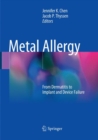 Metal Allergy : From Dermatitis to Implant and Device Failure - Book