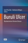 Buruli Ulcer : Mycobacterium Ulcerans Disease - Book