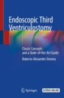 Endoscopic Third Ventriculostomy : Classic Concepts and a State-of-the-Art Guide - Book