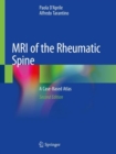 MRI of the Rheumatic Spine : A Case-Based Atlas - Book