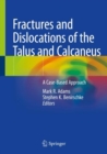 Fractures and Dislocations of the Talus and Calcaneus : A Case-Based Approach - Book