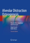 Alveolar Distraction Osteogenesis : The ArchWise Appliance and Technique - Book