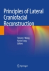 Principles of Lateral Craniofacial Reconstruction - Book