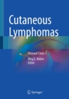 Cutaneous Lymphomas : Unusual Cases 3 - Book