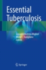 Essential Tuberculosis - Book