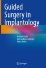Guided Surgery in Implantology - eBook