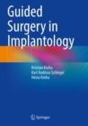 Guided Surgery in Implantology - Book