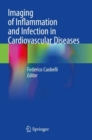 Imaging of Inflammation and Infection in Cardiovascular Diseases - Book