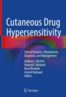 Cutaneous Drug Hypersensitivity : Clinical Features, Mechanisms, Diagnosis, and Management - Book