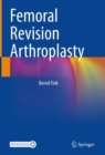 Femoral Revision Arthroplasty - Book