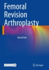 Femoral Revision Arthroplasty - Book