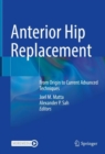 Anterior Hip Replacement : From Origin to Current Advanced Techniques - eBook
