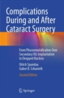 Complications During and After Cataract Surgery : From Phacoemulsification Over Secondary IOL Implantation to Dropped Nucleus - Book
