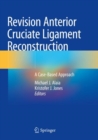 Revision Anterior Cruciate Ligament Reconstruction : A Case-Based Approach - Book