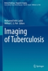 Imaging of Tuberculosis - Book