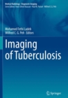 Imaging of Tuberculosis - Book