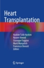 Heart Transplantation - Book