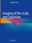 Imaging of the Scalp and Calvarium - eBook