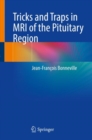 Tricks and Traps in MRI of the Pituitary Region - eBook