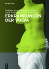 Erkrankungen der Vulva - eBook