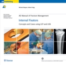 AO Manual of Fracture Management: Internal Fixators : Concepts and Cases using LCP/LISS - Book