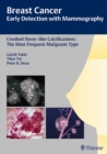 Breast Cancer: Early Detection with Mammography : Crushed Stone-like Calcifications: The Most Frequent Malignant Type - Book